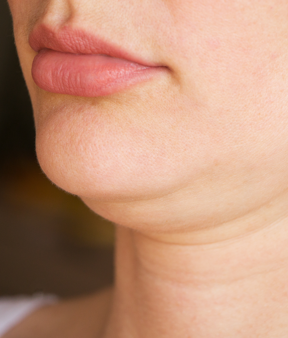 Woman's double chin