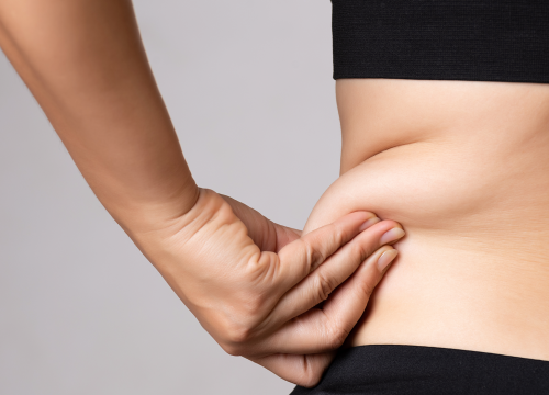 Stubborn fat on a woman's hip