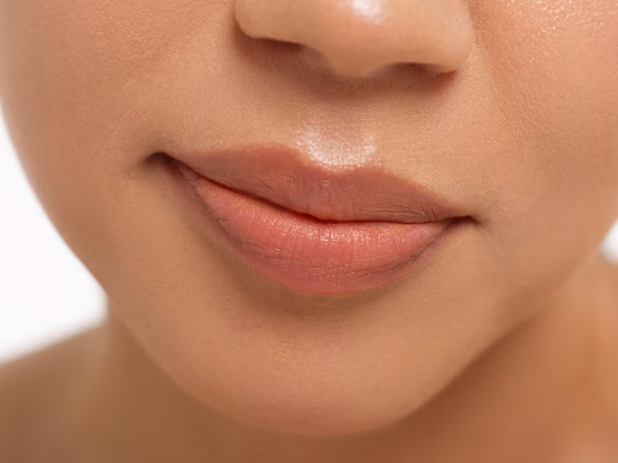 Dermal Fillers