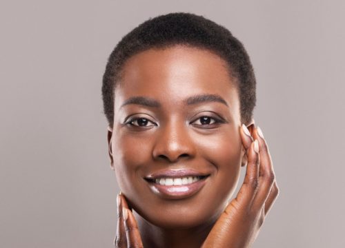 Woman with great skin after SkinPen® microneedling