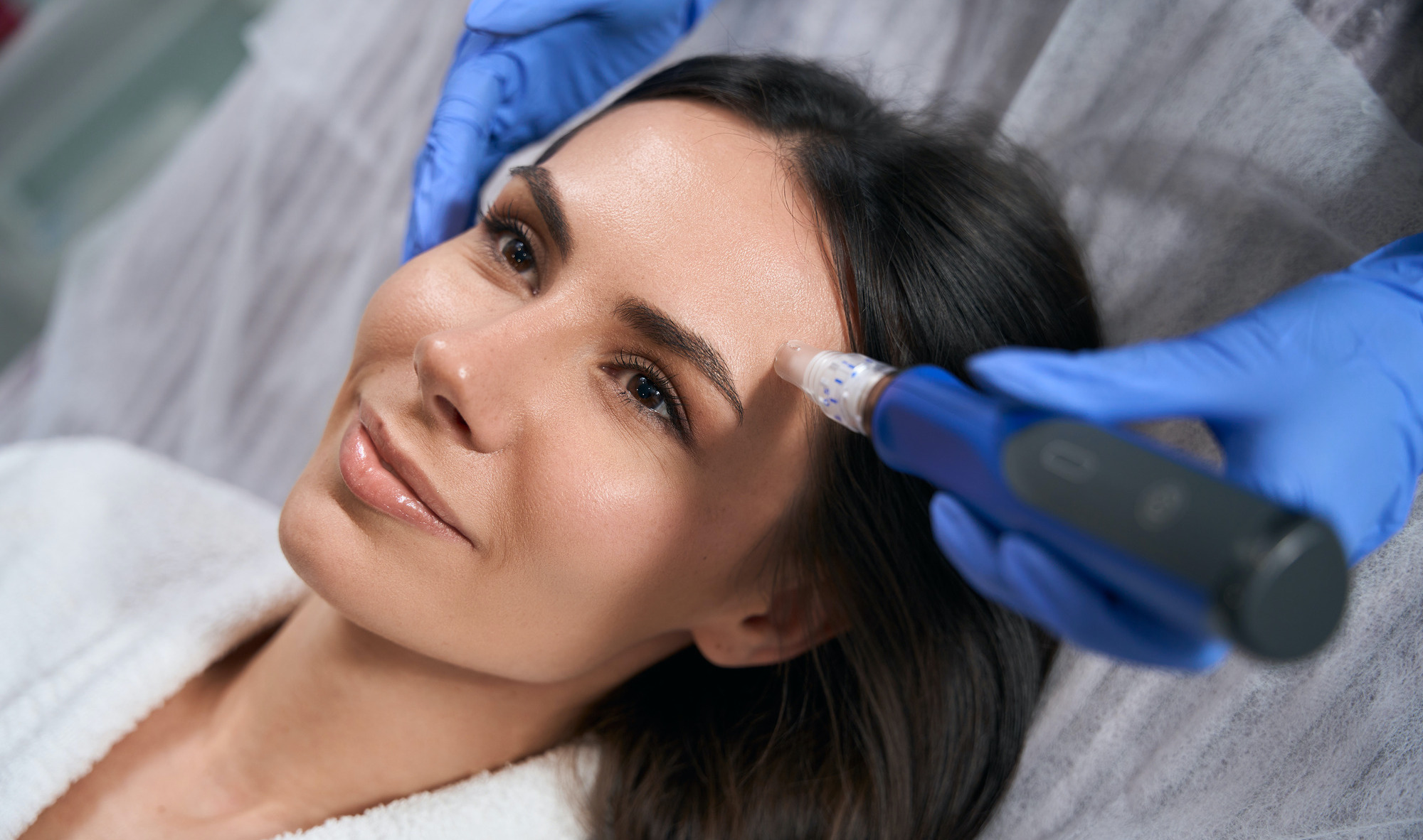 Why You Should Book Microneedling Instead of Using At-Home Devices