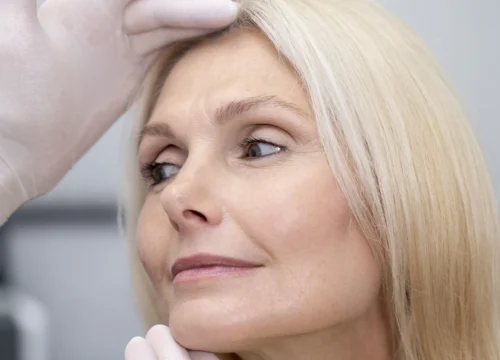 Facial Volume Loss Treatments
